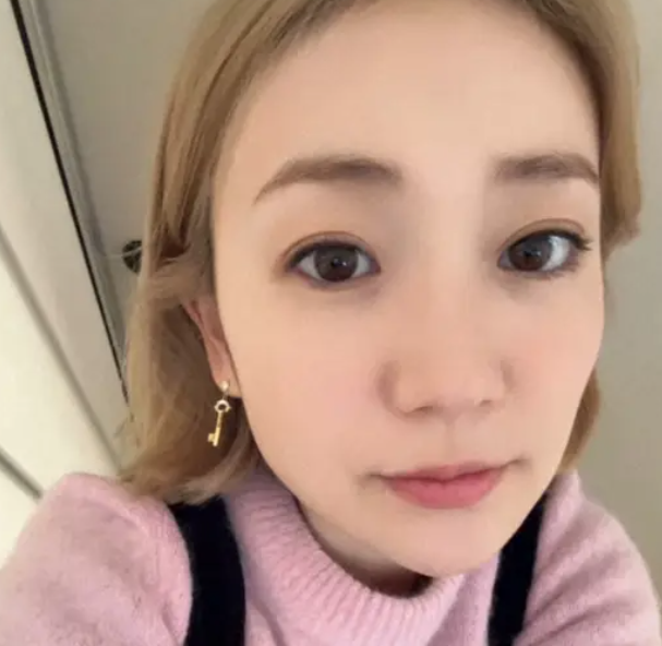 大島優子の金髪と整形疑惑について